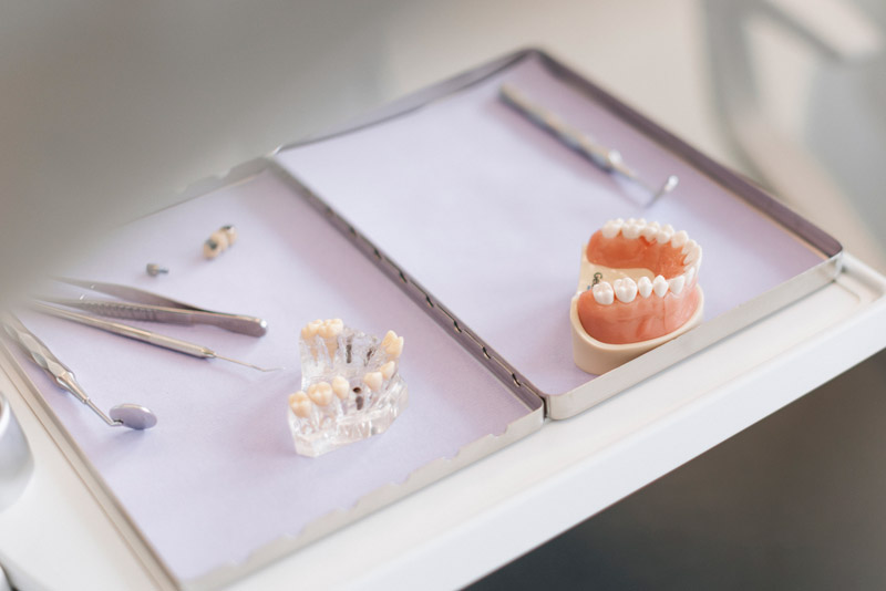 Tray mit Besteck und Modell